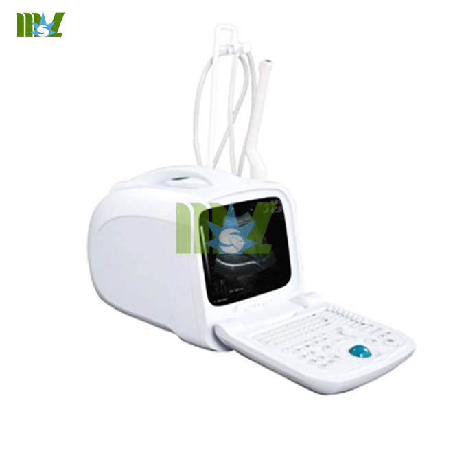 Escáner Ultrasonido Médico Portátil