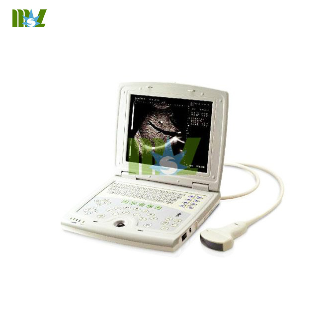 escáner de ultrasonido digital completo para ordenador portátil