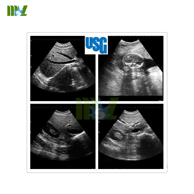 full Digital trolley ultrasound machine MSLTU02-4