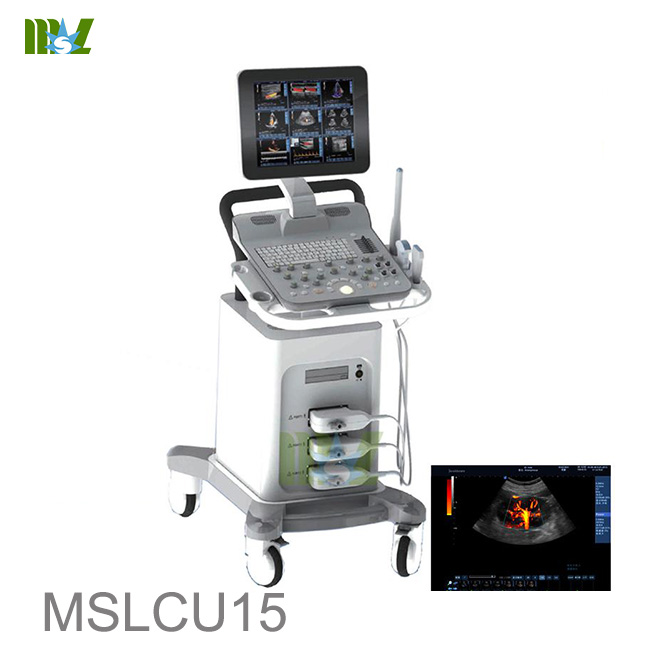  Ultrasonido de embarazo de escaneo 3D/4D en carrito-MSLCU15