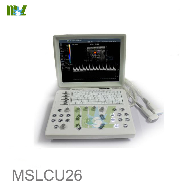 Máquina de Ultrasonido Doppler en Color para Laptop