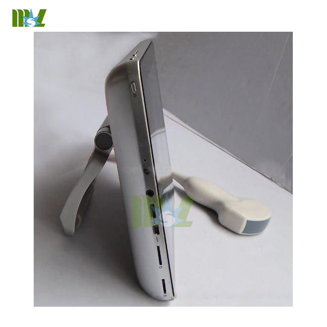 Escáner de ultrasonido portátil en venta MSLPU09