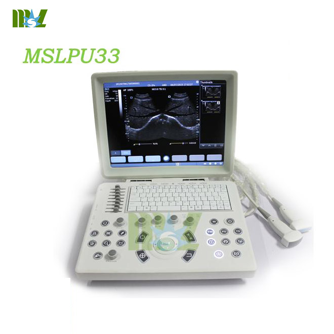 New use laptop as ultrasound machine MSLPU33 for sale