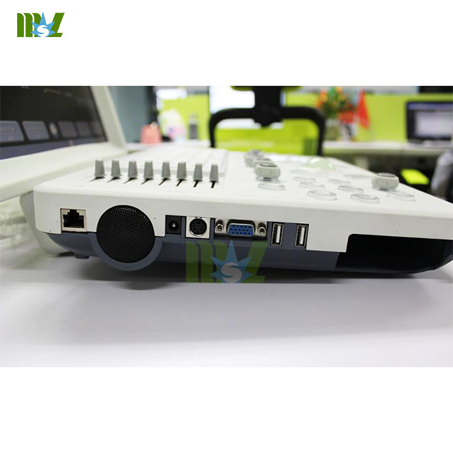 use laptop as ultrasound machine MSLPU33