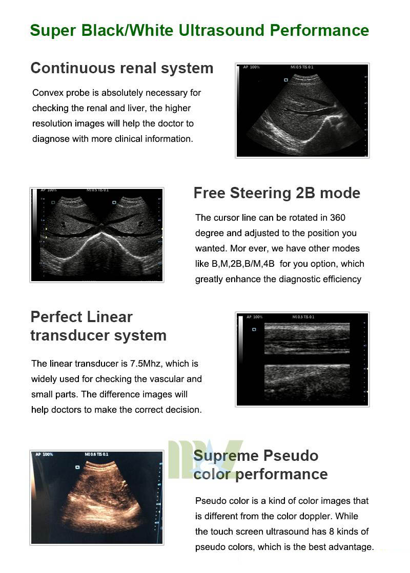 ultrasound machine MSLPU33 for sale