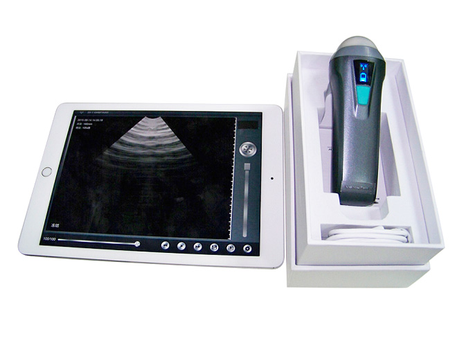 Sonda de ultrasonido inalámbrica portátil MSLPU36 de MSL