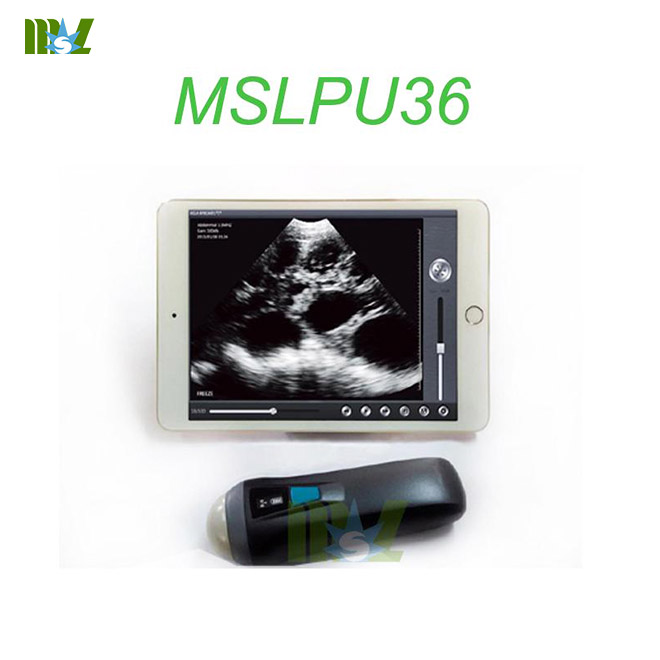 Sonda de ultrasonido inalámbrica portátil MSLPU36 trabajando con iphone/ipad