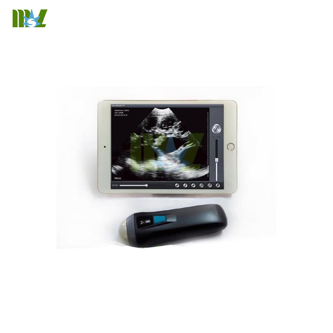 Sonda de ultrasonido inalámbrica MSLPU36 trabajando con iphone/ipad