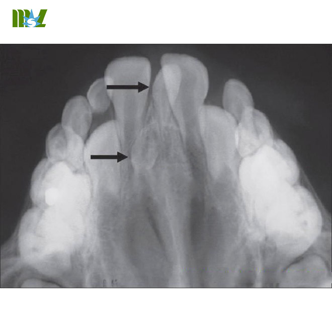 MSL x ray sensor MSLSN01