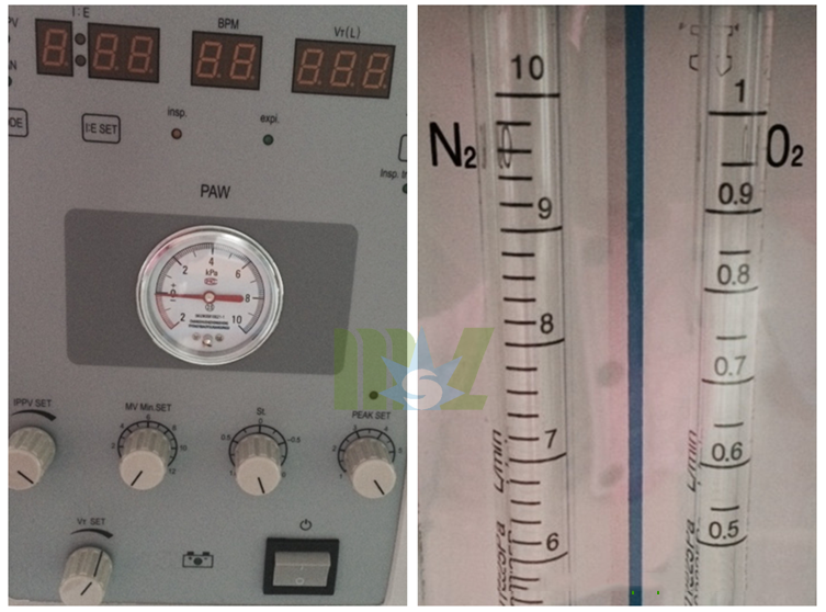 Anestesia Ventilador barato en venta-MSLGA10