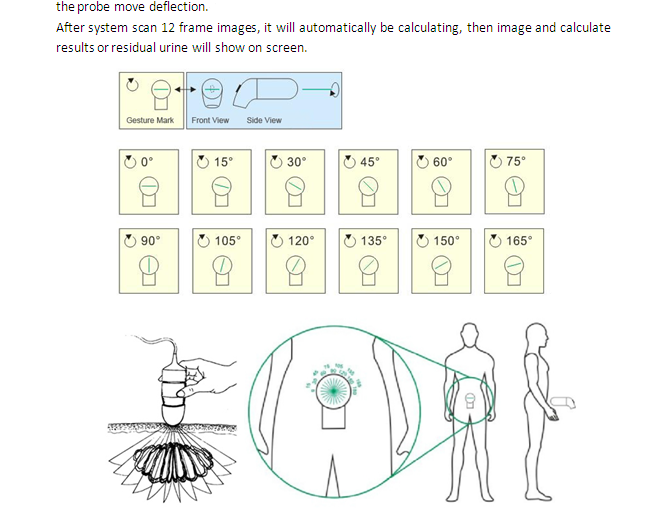 4D Wireless Bladder Scanner for sale