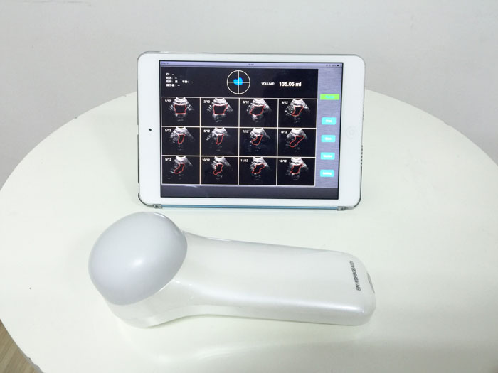 4D Wireless Bladder Scanner Wireless Ultrasound Transducer
