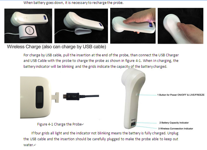 4D Wireless Probe Bladder Ultrasound Scanner supporting apple ios