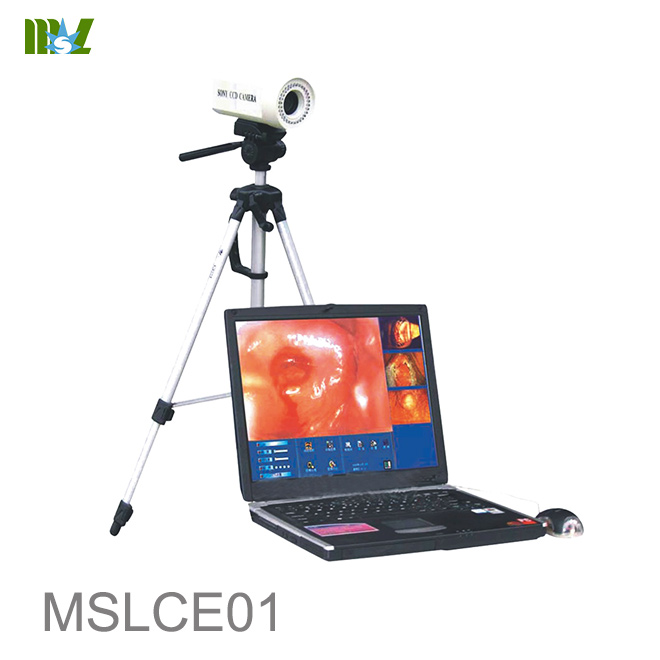 Colposcopio para Laptop MSLCE01