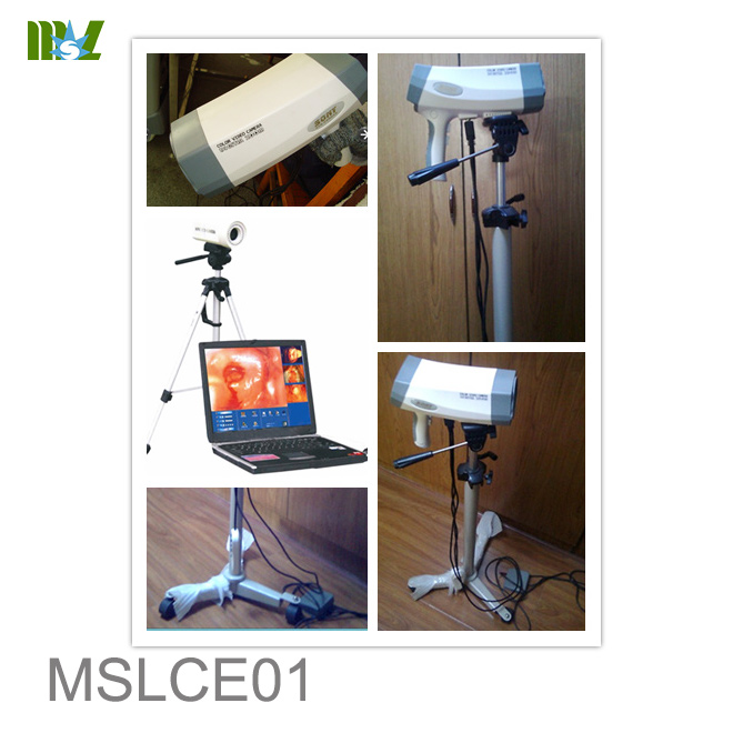 Colposcopio para Laptop para uso en mujeres MSLCE01