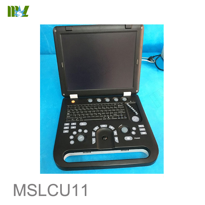 3d color ultrasound