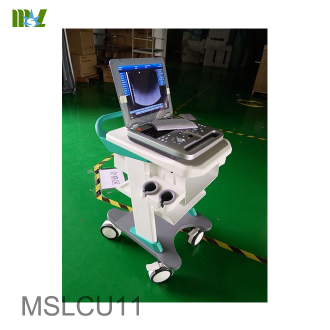 3d doppler color ultrasound