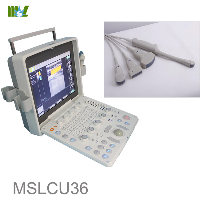 ecografía abdominal MSLCU36