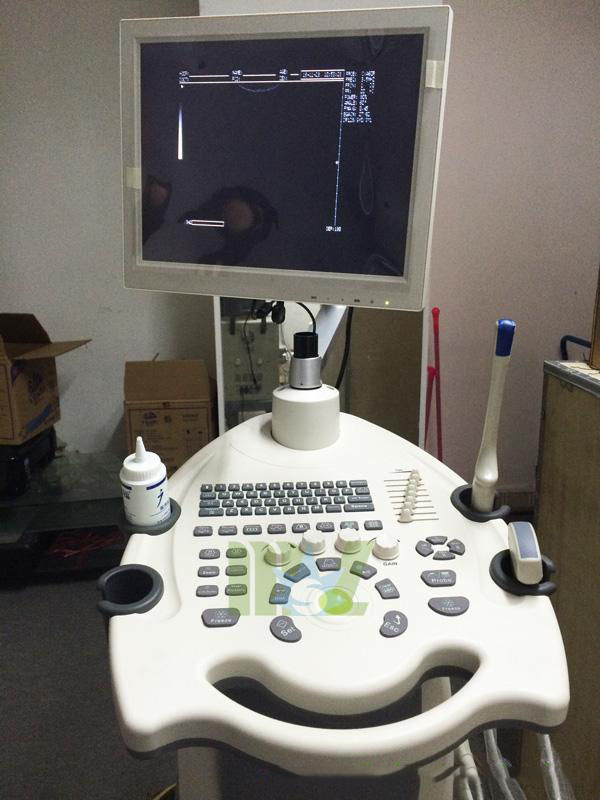 Trolley 3D 4D Color Doppler Ultrasound