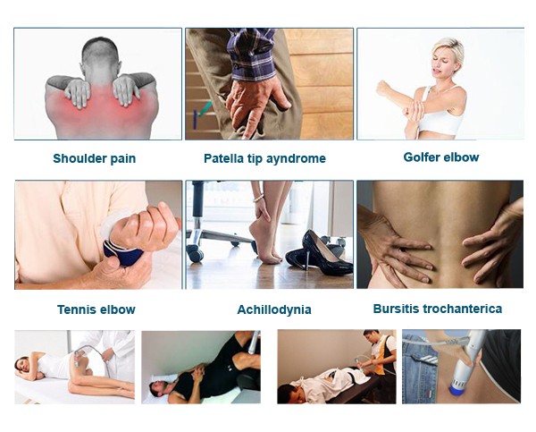 Máquina Avanzada de Terapia Física para Alivio del Dolor Corporal MSLST02