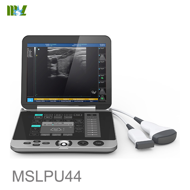 Equipo de ultrasonido portátil con teclado de pantalla táctil MSLPU44