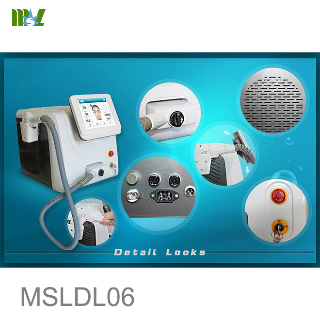Costo de la depilación láser MSLDL06