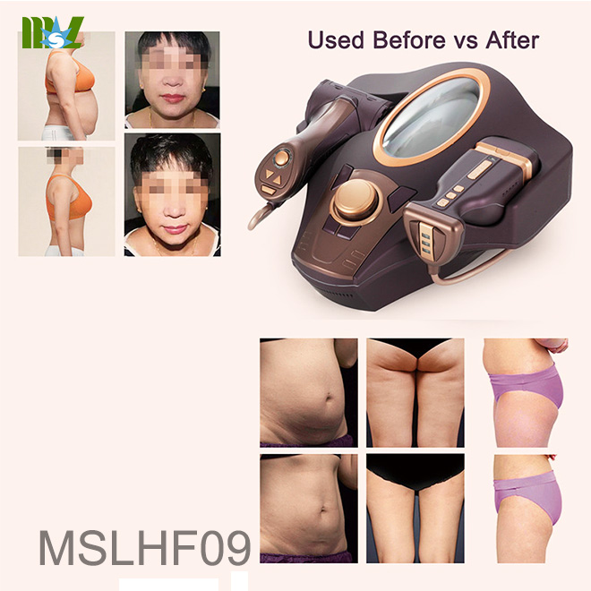 Máquina de equipos para perder peso MSLHF09