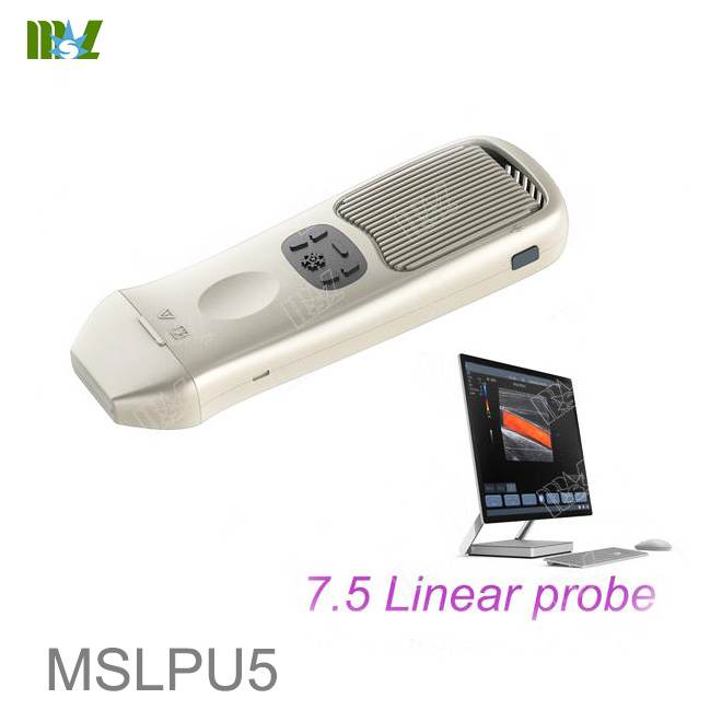 precio de la máquina de ultrasonido