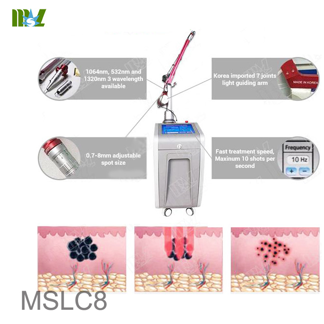 Eliminación de pigmentación con láser YAG Q-switch