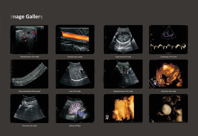 SIUI General color Doppler system