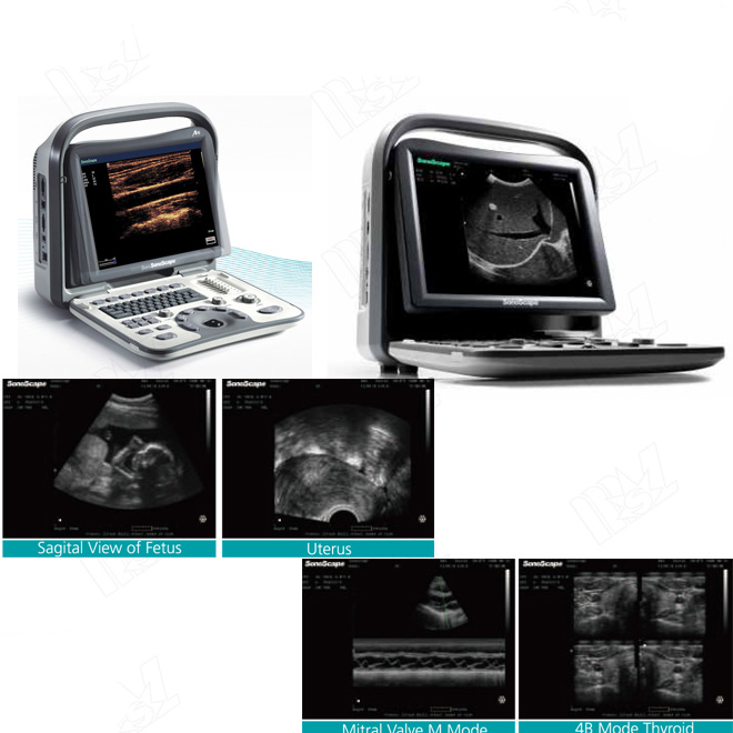 ecografi sonoscape a5