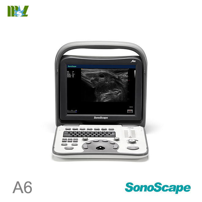 sonoscape a6 brochure