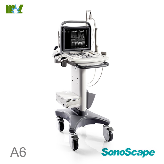 sonoscape a6 price