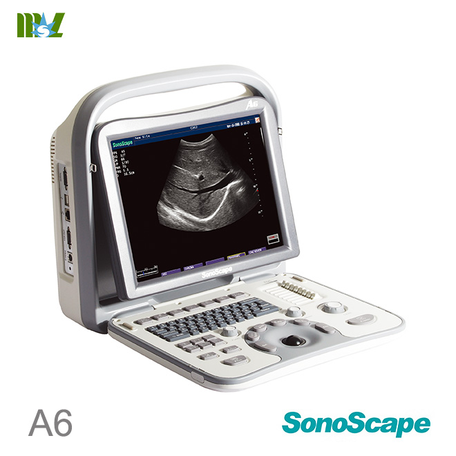 a6 sonoscape