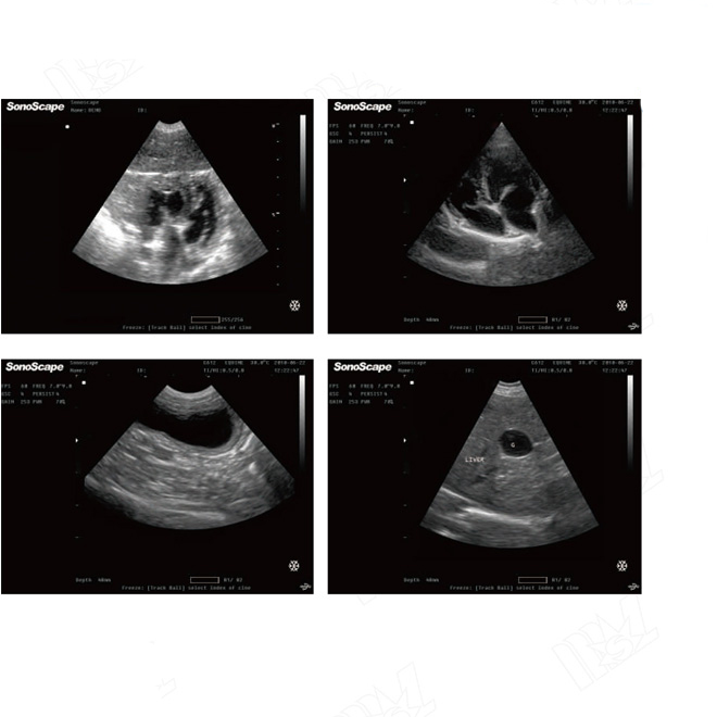 ultrasonido obstetrico pdf