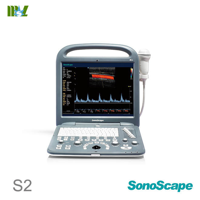 ultrasonido 4d