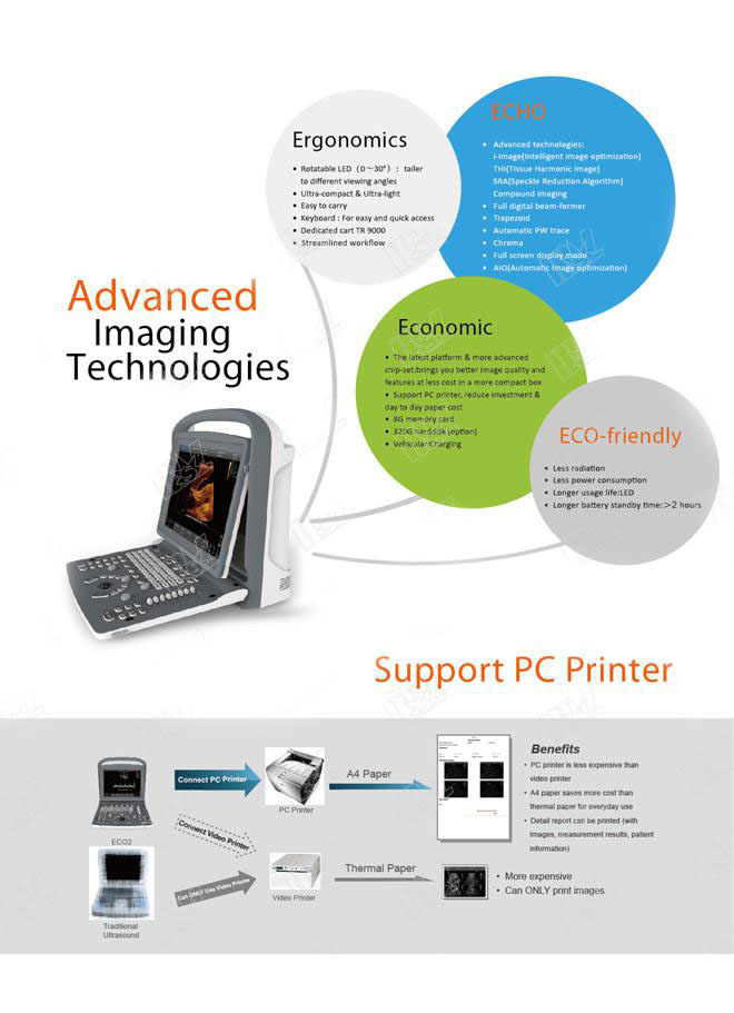 ultrasound musculoskeletal chison eco 2