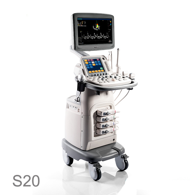 sonoscape ultrasound