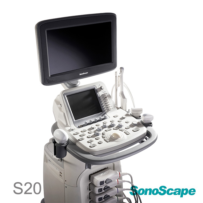sonoscape ultrasound price