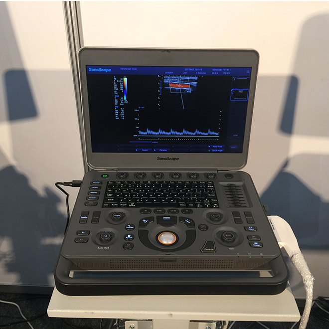sonoscape ultrasound X3 price