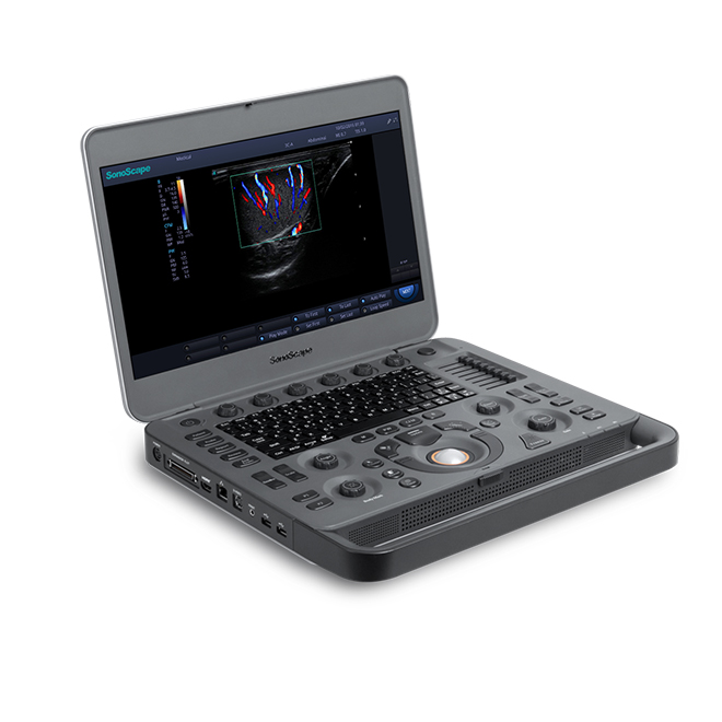 sonoscape ultrasound X3