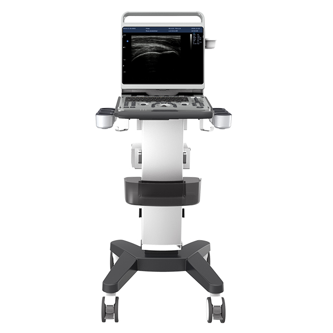 Chison ultrasound Ebit 50