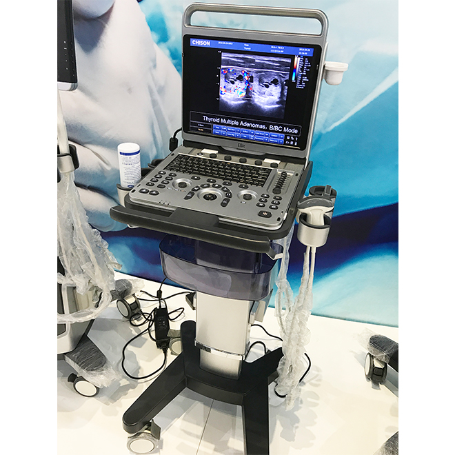 ecografie doppler Chison Ebit 50