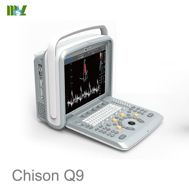 Chison Q9 price