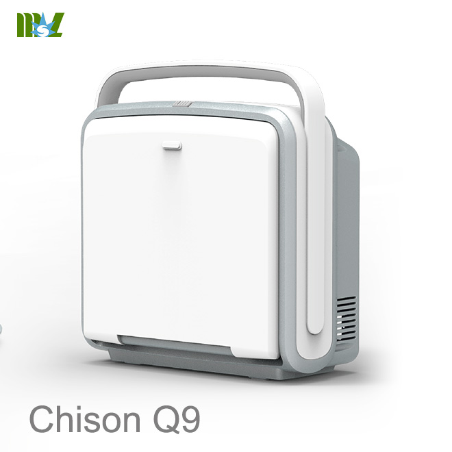 Chison Q9 review