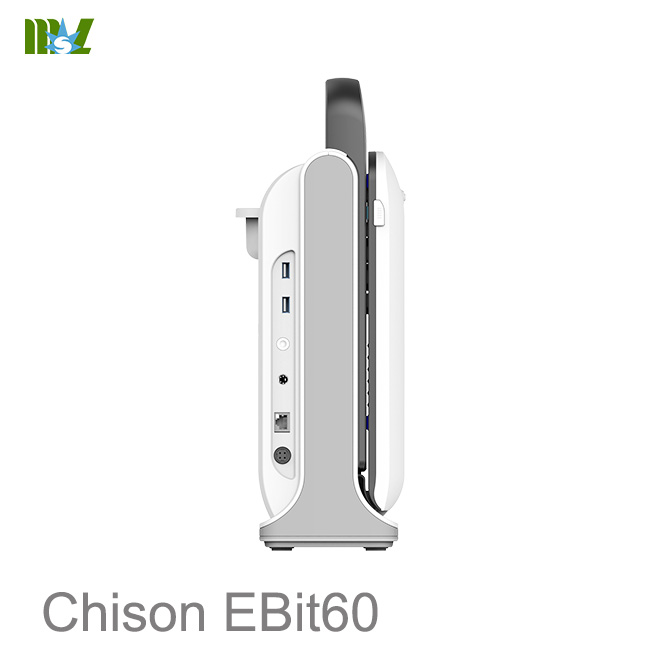 Ecografie parti moi Chison EBit 60