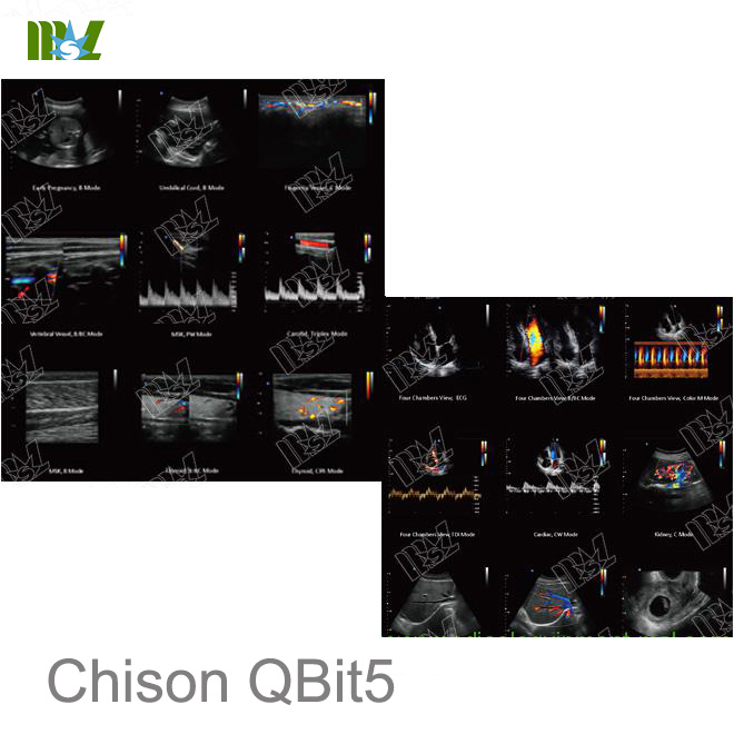 ecografía veterinaria Chison QBit 5
