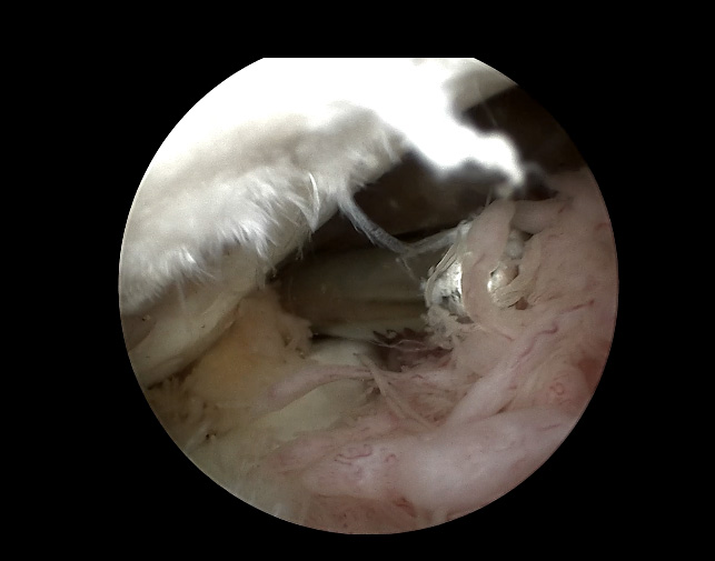 cámara de endoscopio HD para android