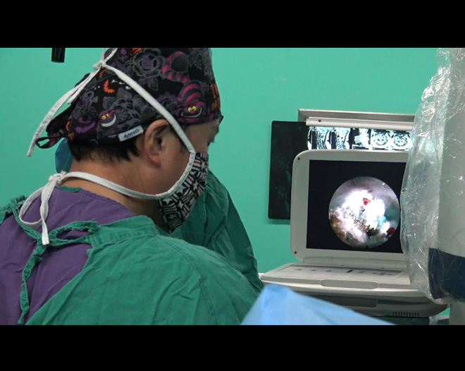 endoscopio médico HD