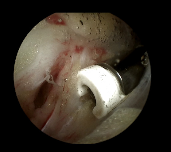 cámara de inspección de endoscopio HD
